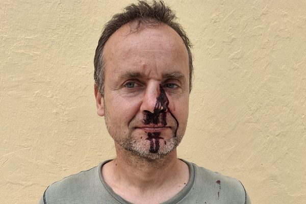 Bei einem Angriff auf Vogelschützer wurde einem slowenischen Komitee-Mitarbeiter die Nase gebrochen